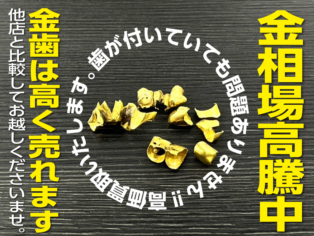 金歯は高く売れます